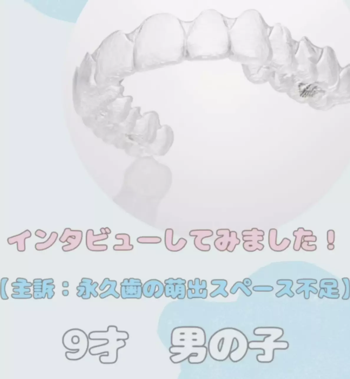 インビザライン感想