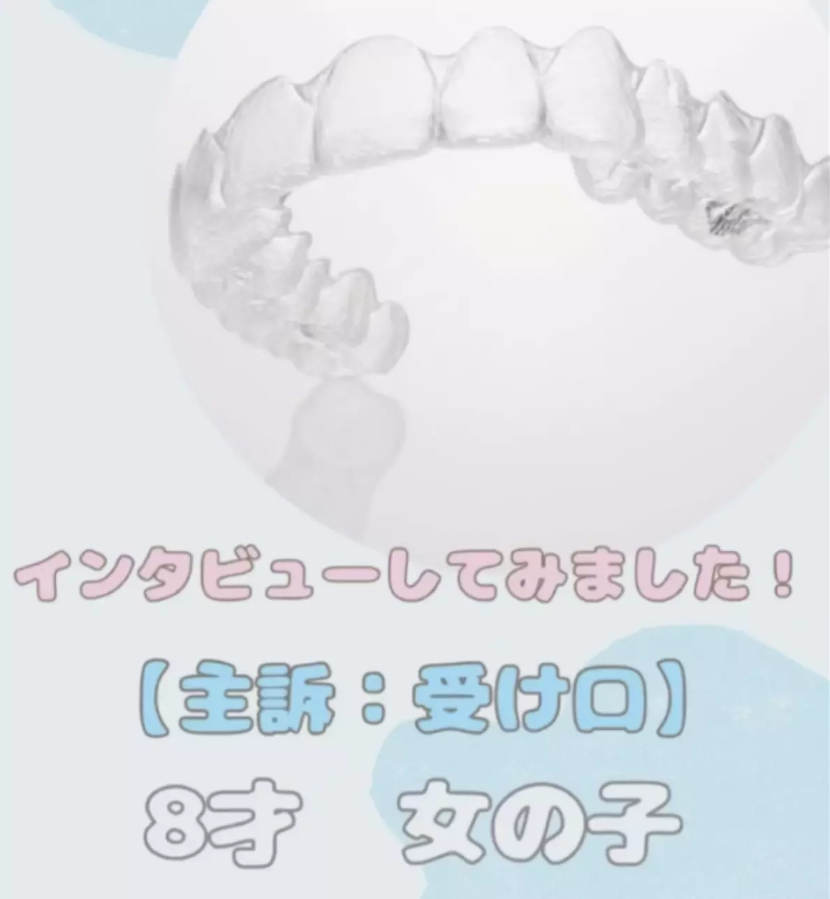 インビザライン感想