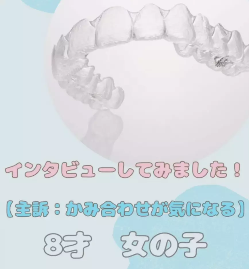 インビザライン感想