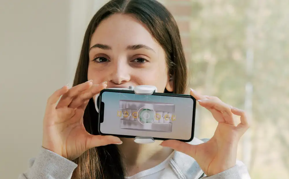 デンタルモニタリング